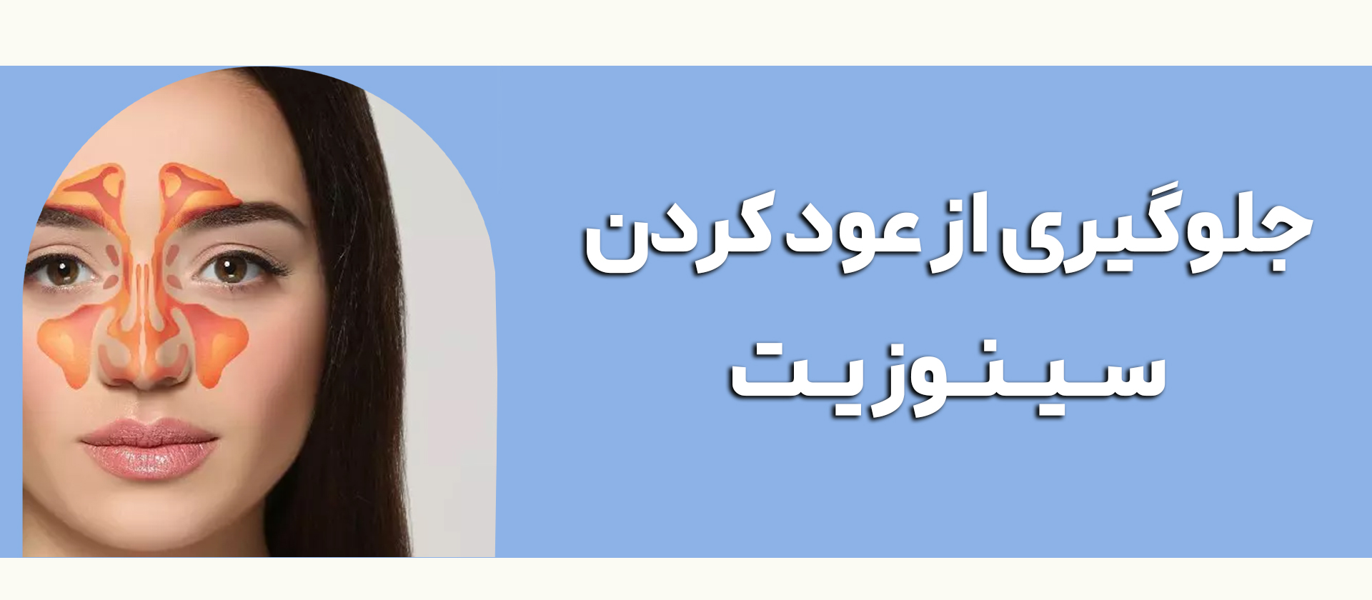 سینوزیت